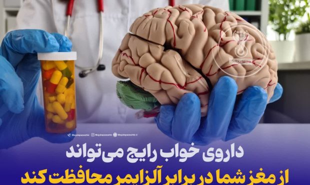 داروی خواب رایج می‌تواند از مغز شما در برابر آلزایمر محافظت کند