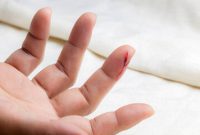 میوه‌هایی که زخم را التیام می‌دهند